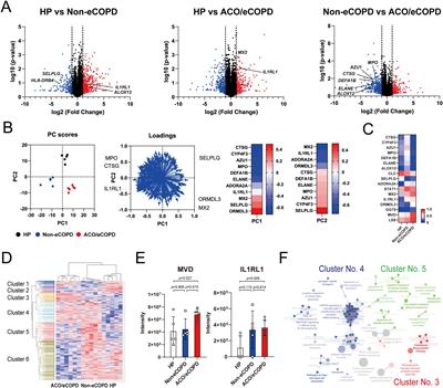 Inflammatory profile of eosinophils in asthma-COPD overlap and eosinophilic COPD: a multi-omics study